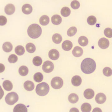 Macrocytes | CellWiki