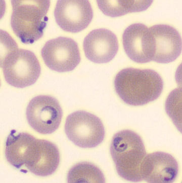 Plasmodium falciparum | CellWiki