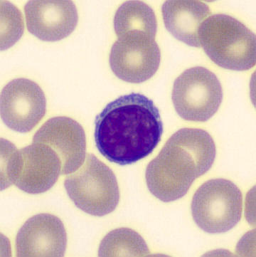 Lymphocyte | CellWiki